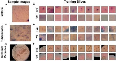 Hardware-Efficient Stochastic Binary CNN Architectures for Near-Sensor Computing